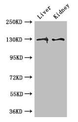 Polyclonal Rabbit anti-Human PC / Pyruvate Carboxylase Antibody (IHC, IF, WB)