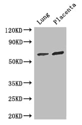 Polyclonal Rabbit anti-Human STAU1 / Staufen Antibody (IHC, IF, WB)