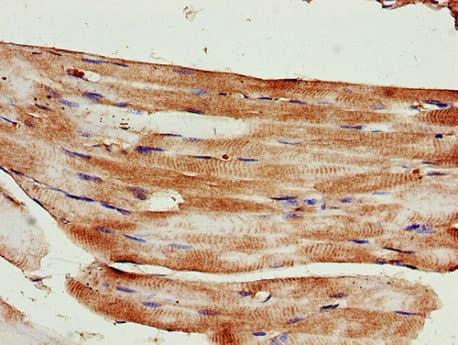 KIF14 Antibody