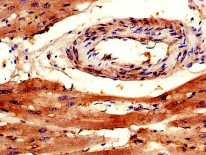 TRAPPC9 Antibody