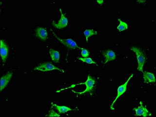 Polyclonal Rabbit anti-Human NES / Nestin Antibody (IF)