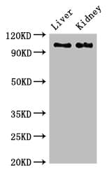 Polyclonal Rabbit anti-Human Complement C6 Antibody (IHC, WB)