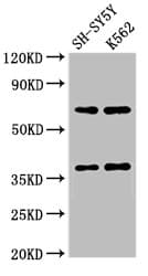 Polyclonal Rabbit anti-Human CTSH / Cathepsin H Antibody (IHC, WB)