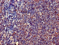 Polyclonal Rabbit anti-Human ERN1 / IRE1 Antibody (IHC)