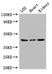 Polyclonal Rabbit anti-Human MAP2K1 / MKK1 / MEK1 Antibody (IHC, WB)