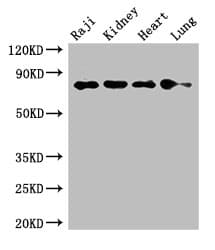 PECAM-1 / CD31 Antibody