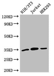 Polyclonal Rabbit anti-Human SPRY2 / Sprouty 2 Antibody (IHC, IF, WB)