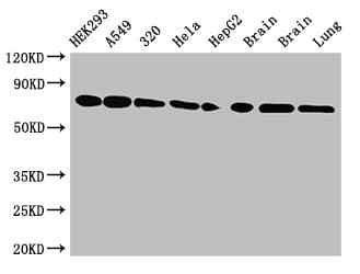 Polyclonal Rabbit anti-Human HSPA8 / HSC70 Antibody (IHC, WB)