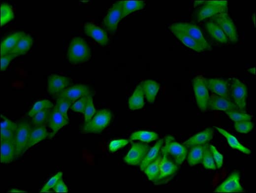 Polyclonal Rabbit anti-Human FGF23 Antibody (IF)