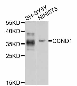 Polyclonal Rabbit anti-Human CCND1 / Cyclin D1 Antibody (IHC, IF, WB)