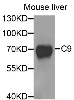 Polyclonal Rabbit anti-Human Complement C9 Antibody (IHC, WB)