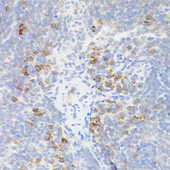 Polyclonal Rabbit anti-Human TNFRSF13B / TACI Antibody (IHC, WB)