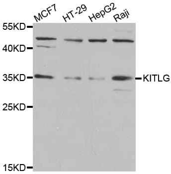 Polyclonal Rabbit anti-Human KITLG / SCF Antibody (IHC, WB)