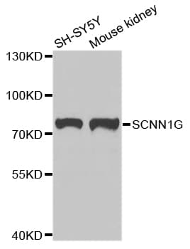 Polyclonal Rabbit anti-Human SCNN1G / ENaC Gamma Antibody (IHC, WB)