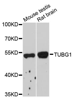 Polyclonal Rabbit anti-Human TUBG1 / Tubulin Gamma 1 Antibody (IHC, WB)