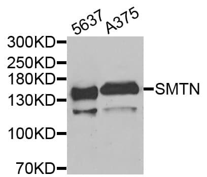 Polyclonal Rabbit anti-Human Smoothelin Antibody (WB)