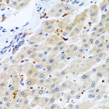 Polyclonal Rabbit anti-Human RGS5 Antibody (IHC, WB)