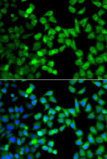 Polyclonal Rabbit anti-Human SMIF / DCP1A Antibody (IHC, IF, WB)
