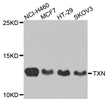Polyclonal Rabbit anti-Human TXN / Thioredoxin / TRX Antibody (IHC, WB)