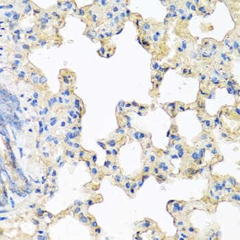 Polyclonal Rabbit anti-Human CP / Ceruloplasmin Antibody (IHC, WB)
