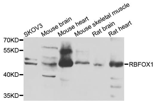 Polyclonal Rabbit anti-Human RBFOX1 / A2BP1 Antibody (IHC, WB)