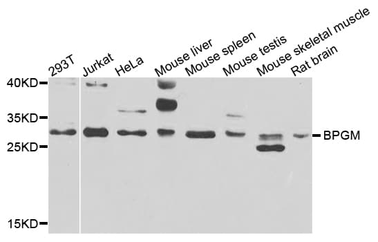 Polyclonal Rabbit anti-Human BPGM Antibody (IHC, WB)