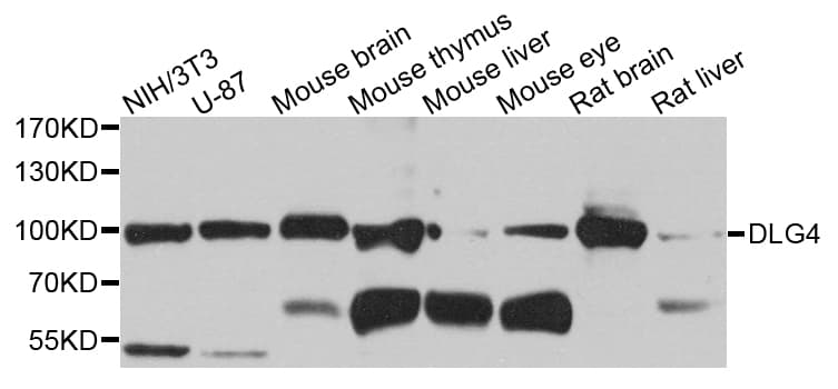 Polyclonal Rabbit anti-Human DLG4 / PSD95 Antibody (WB)