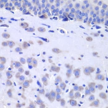 Polyclonal Rabbit anti-Human HTT / Huntingtin Antibody (IHC, WB)