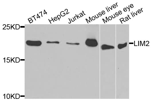 Polyclonal Rabbit anti-Human LIM2 Antibody (IHC, WB)