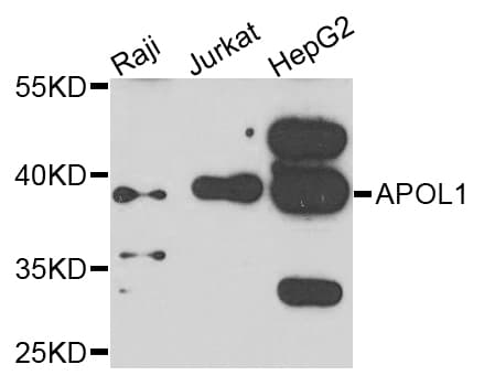 Polyclonal Rabbit anti-Human APOL1 / Apolipoprotein L Antibody (AP, IHC, WB)