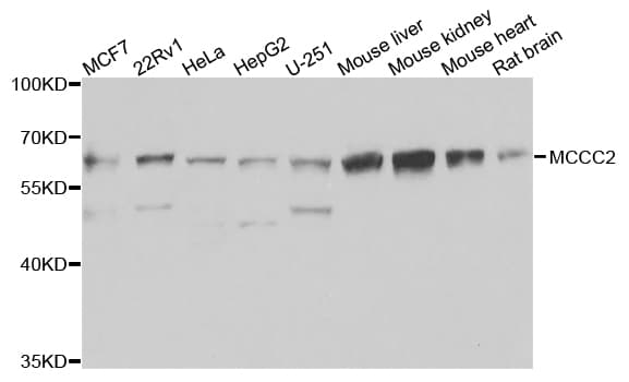 Polyclonal Rabbit anti-Human MCCC2 / MCCB Antibody (IHC, WB)