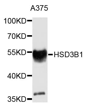 Polyclonal Rabbit anti-Human HSD3B1 Antibody (aa1-290, IHC, WB)