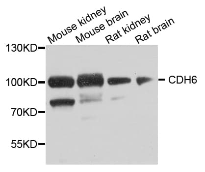Polyclonal Rabbit anti-Human CDH6 / K Cadherin Antibody (IHC, WB)