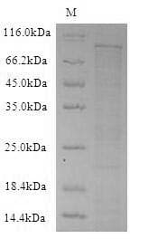 Mouse DPP4 / CD26 Protein (Recombinant 6His-SUMO, N-terminus)