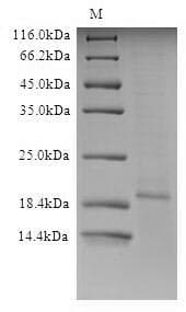 Influenza A Virus Influenza A H5N1 M2 Protein (Recombinant 6His, N-terminus)