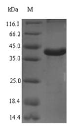 Rat Complement C1QA Protein (Recombinant 6His-SUMO, N-terminus)