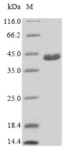Human C21orf2 Protein (Recombinant)