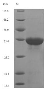 Human CD8A / CD8 Alpha Protein (Recombinant 6His-SUMO, N-terminus)