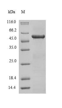 Human TPM3 Protein (Recombinant GST, N-terminus)