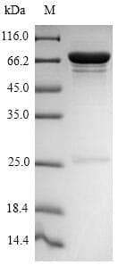 Influenza A Virus Nucleocapsid Protein (Recombinant 6His-SUMO, N-terminus)