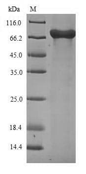 Influenza A Virus Nucleocapsid Protein (Recombinant 6His-SUMO, N-terminus)