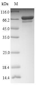 Influenza A Virus Nucleocapsid Protein (Recombinant 6His-SUMO, N-terminus)