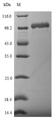 Influenza A Virus Nucleocapsid Protein (Recombinant 6His-SUMO, N-terminus)