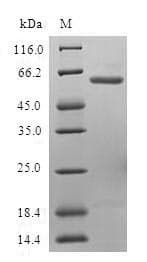 Human UFD1L Protein (Recombinant GST, N-terminus)