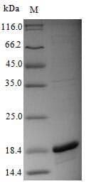Influenza A Virus PA / Polymerase Acidic Protein (Recombinant 6His, N-terminus)