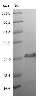 Human CD8A / CD8 Alpha Protein (Recombinant 6His, N-terminus)