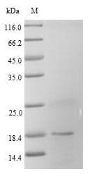 Rat FABP3 / H-FABP Protein (Recombinant 6His, N-terminus)
