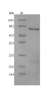 Human ALDH1A3 Protein (Recombinant 6His, N-terminus)