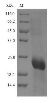 Human CD8A / CD8 Alpha Protein (Recombinant 6His, N-terminus)
