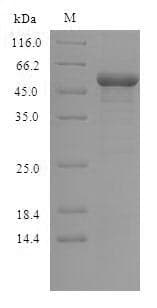Human GSK3B / GSK3 Beta Protein (Recombinant 6His, N-terminus)